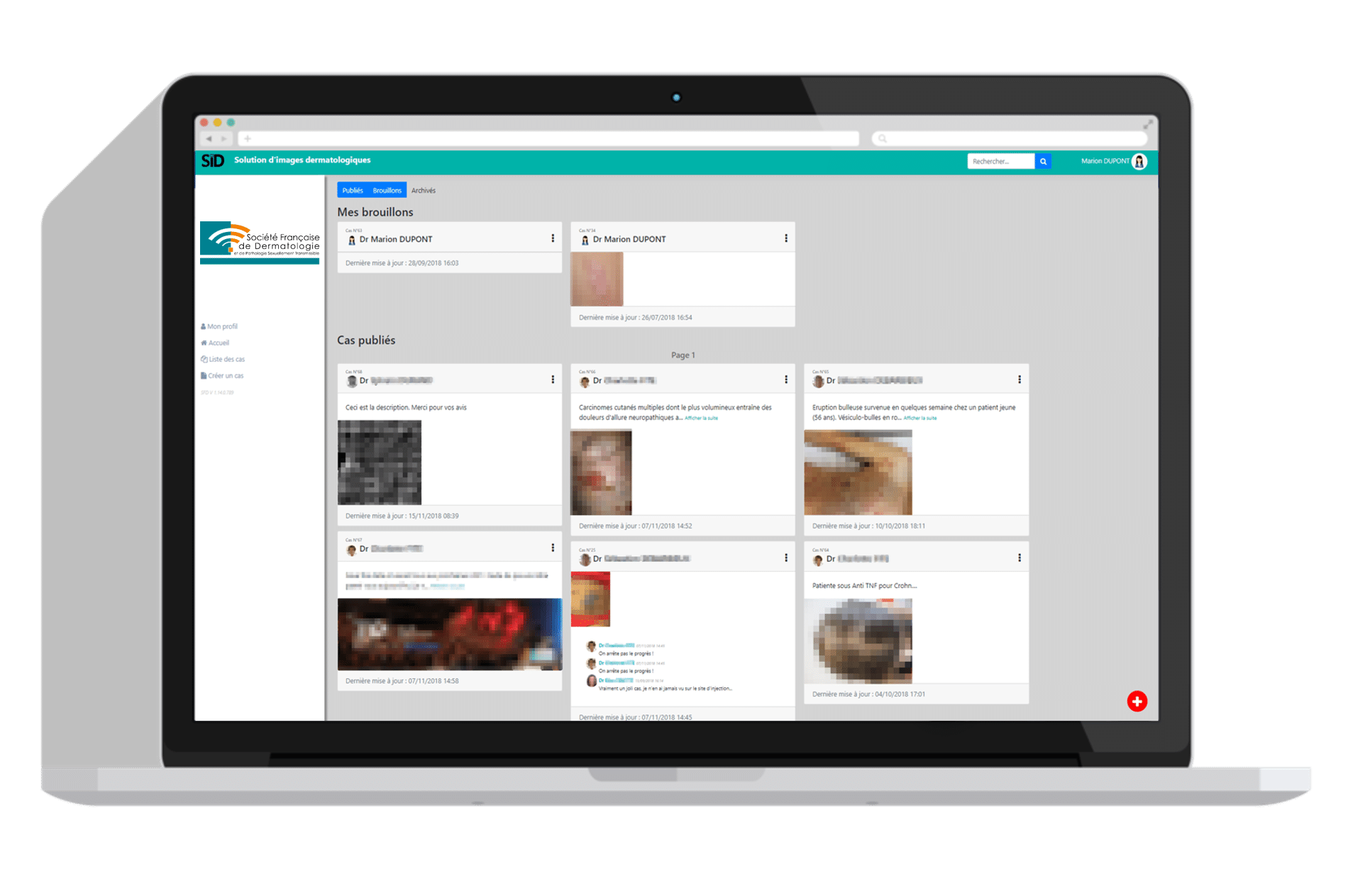 Solution d'images dermatologie SFD Solution d'images dermatologie SFD