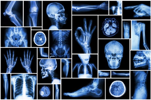 radiographie deeplink medical
